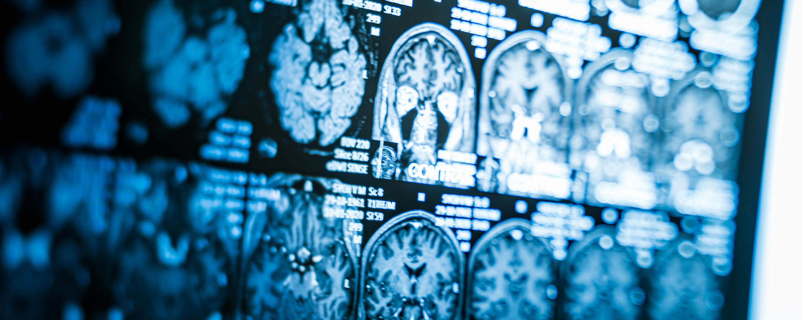 Stock photo of brain scans, brain activity for story on what makes persuasive messages stick.