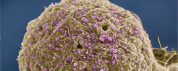 Rendering of an HIV infected cell.